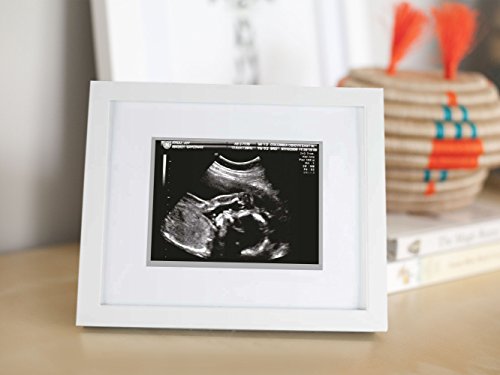 Pearhead Sonogram Photo Frame, Wall Mount An Tabletop Picture Frame, Baby Ultrasound Keepsake, White #TOP1