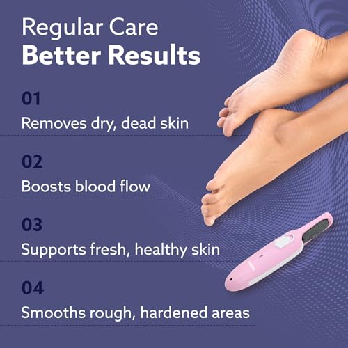 Image of AGARO Electric Callus Remover with 2 Replaceable Heads - Rechargeable Foot Scrubber for Dead Skin & Cracked Heels Pedicure Machine with 120 Minutes Runtime CR1717