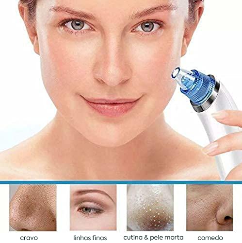Sucção 4 em 1 Extrator de cravos brancos Dispositivo removedor de acne Acne Pimple Pore Cleaner Ferr