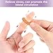 Spiky Sensory Rings, 12 Pack, Stress Relief Fidget Sensory Toys, Fidget Rings, Fidget Ring for Anxiety, Stress Relief Rings, Massager for Fidget ADHD Autism, Back to School Supplies (Gold)