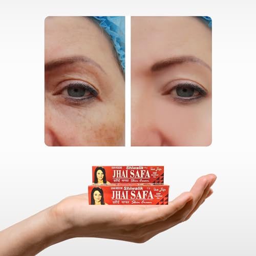 Image of Shiwalik Skin Cream - Natural Blemish And Spot Reduction, Nourishing Formula, Suitable For All Skin Types, 15G