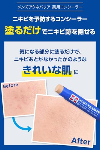 Acne Barrier メンズアクネバリア 薬用コンシーラー ライト 5g の商品画像 2