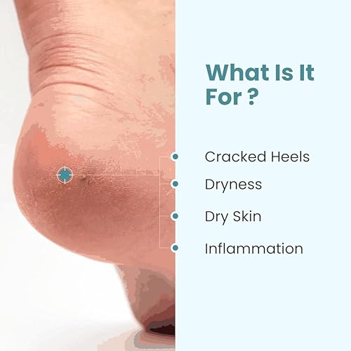 Image of Khadi Herbal Foot Care Cream Repairs Cracked Heel | Crack Heel Repair Cream For Women & Men, Moisturizes Dry Feet, Combats Feet Odour & Infections (Pack Of 2-200gm)