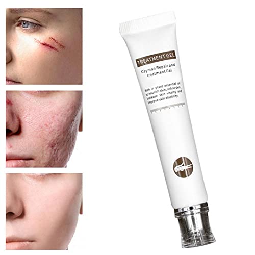 Littekenverwijdering Cream Acne Markeringen Remover Gel Skin Reparatie Burns Acne Spots Behandeling Optimale Restauratie… - Image 3