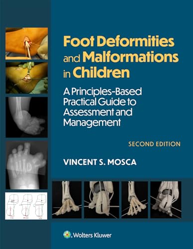 Foot Deformities and Malformations in Children: A Principles-Based, Practical Guide to Assessment and Management: eBook without Multimedia