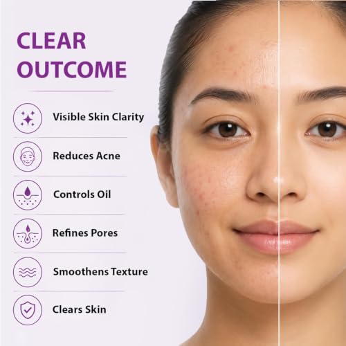 Image of Dermistry 2% Salicylic Acid 5% Niacinamide Anti Acne Oil Clear Face Serum for Oil Control Acne Marks Pimples Exfoliating Open Pores Suits Oily Acne Prone Skin for Men Women Boys Girls 30ml