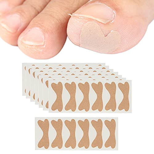 Kirkland Signature H.k Anderson Valencia Peanut Butter Filled Pretzel Nuggets: 52 Oz #TOP2