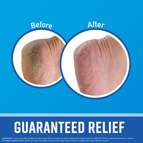 O'Keeffe's Healthy Feet Foot Cream, Relieves and Repairs Extremely Dry Cracked Feet, Instantly Boosts Moisture, 3 oz / 85 g, Tube, (Pack of 1) - Image 4