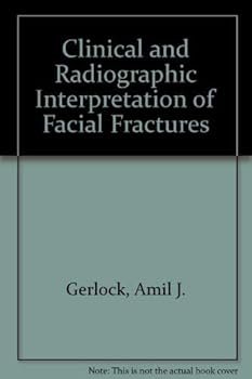 Hardcover Clinical/Radiog Facial Fract Book