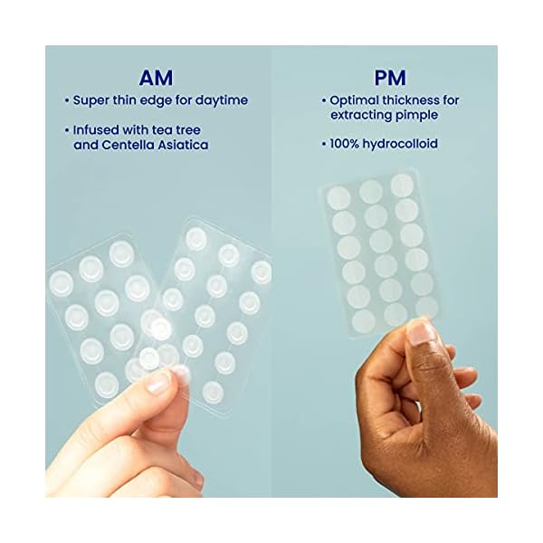 FACETORY Spot Fighter Acne Blemish Patches for Pimples (150 Counts)- Day and Night Options, Hydrocolloid Patches for Acne Spot Treatment (2 Sizes Each Pack)