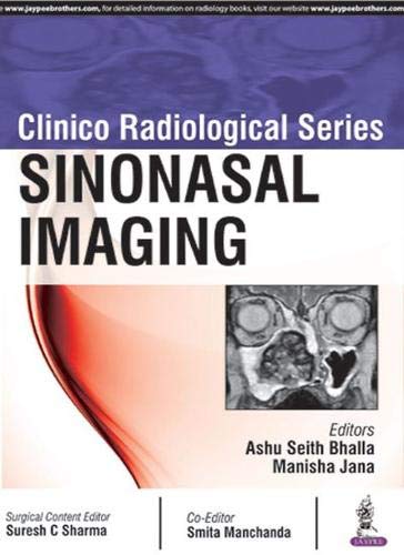 Clinico Radiological Series: Sinonasal Imaging