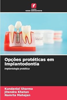 Paperback Opções protéticas em Implantodontia [Portuguese] Book