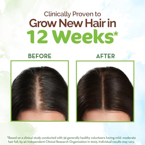 Mamaearth Rosemary Hair Growth Oil with Rosemary & Methi Dana for Promoting Hair Growth - 150 ml | Controls Hair Fall | Strengthens Hair - Image 7