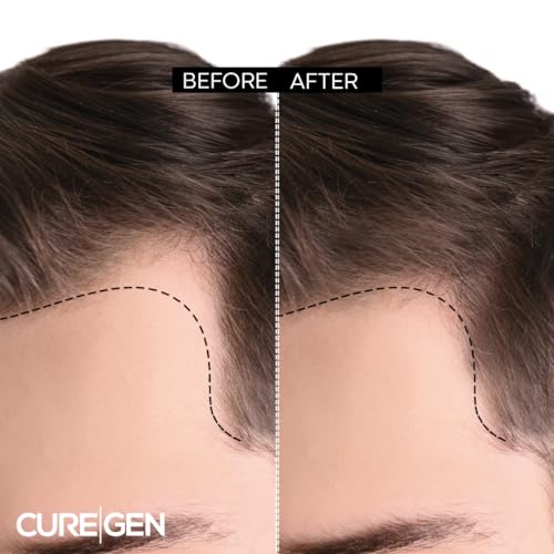 Curegen Biotin Shampoo for Hair Growth and Thinning Hair â Thickening Formula for Hair Loss Treatment â For Men & Women - Image 3