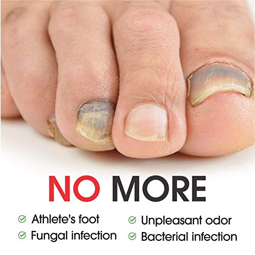 All Natural Nail Fungus Treatment – Made in USA, Best Nail Repair Product, Stop Fungal Growth, Effective Fingernail & Toenail Solution, Fix & Renew Damaged, Broken, Cracked & Discolored Nails