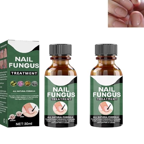 Soluzione per La Riparazione Delle Unghie,Liquido Fungo per Unghie,Liquido per Infezione delle Unghie,Soluzione per La Riparazione delle Unghie del Piede,Trattamento antimicotico Extra Forte 2pc