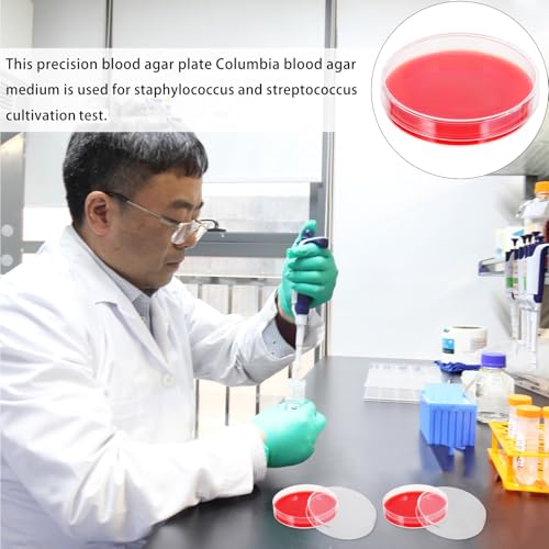 Placas de agar de sangre de 10 unidades y 70mm para análisis clínicos en laboratorios 8