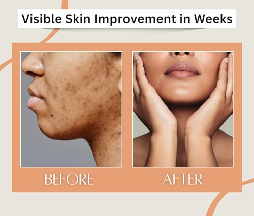 Image of Earth N Pure Babchi Oil (Bakuchi Oil) Cold Pressed, Natural & Therapeutic Grade with Glass Dropper - 50 ml