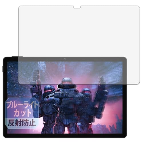 Leipsden DOOGEE U11 �Ή� Blue Shield �ی� �t�B���� �u���[���C�g�J�b�g �ڂɗD���� ���˒ጸ ���{��