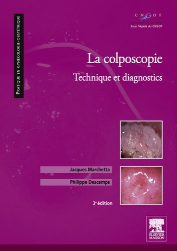 La colposcopie: Technique et diagnostics (Pratique en gynécologie-obstétrique) Livre PDF Gratuit