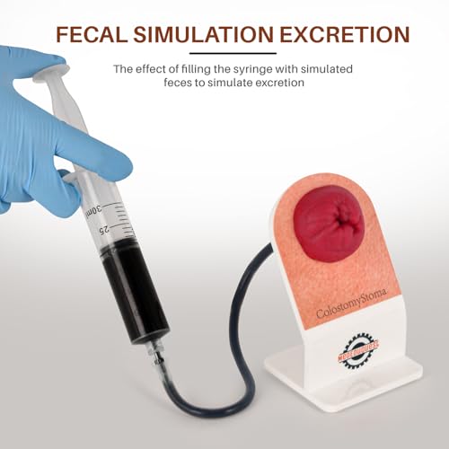Kit de formation pour stomie : apprenez à éviter les erreurs de soins - 4