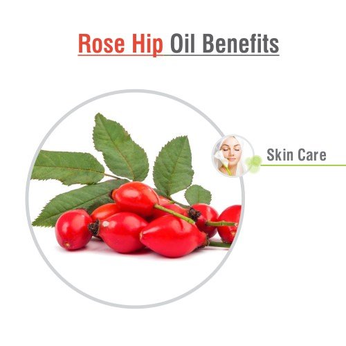 Image of Crysalis Rosehip (Rosa Canina L.) Oil |100% Pure & Natural Undiluted Essential Organic Rosehip Oil For Anti-Aging Benefits, Enhances Elasticity And Moisturization, Reduce Dark Spot (10ml)