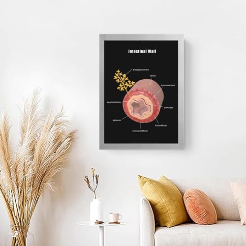 Image of Taanfu Body Educational Learning Anatomy Posters ，Intestine Wall Art Intestinal Villi Anatomy Art Poster Digestive System Organs Illustration Small Intestine Physiology Anatomy Wall Art Villi