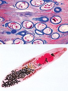 3B Scientific GmbH W13323S General Parasitology-Spanish 50 Microscope Slides