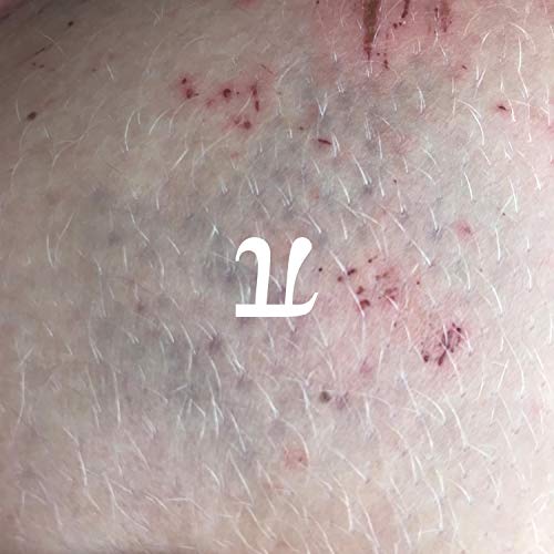  Pi\'s Ballade