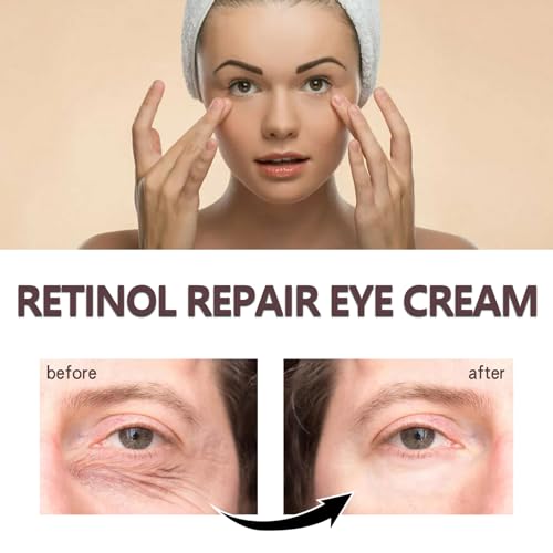 Retinol Eye Cream, Eye Cream for Dark Circles Puffy Eyes, Anti Wrinkle Eye Cream, Firming Eye Cream Against Wrinkles with Retinol and Hyaluronic Acid, Eye Cream Anti Aging for All Skin Types - Image 7