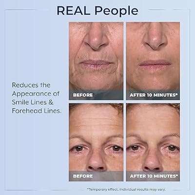 Plexaderm Rapid Reduction Eye Serum - Visibly Reduces Under-Eye Bags, Wrinkles, Dark Circles, Fine Lines & Crow's Feet Instantly, Anti Aging Wrinkle Remover for Face, Full Size Tube