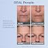 Plexaderm Rapid Reduction Eye Serum - Visibly Reduces Under-Eye Bags, Wrinkles, Dark Circles, Fine Lines & Crow's Feet Instantly, Anti Aging Wrinkle Remover for Face, Full Size Tube