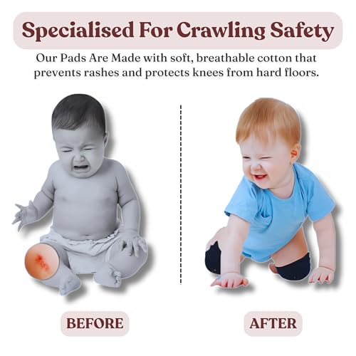 Image of Windson Baby Knee Pads Set of 2 Pairs for Toddlers, Baby Elbow & Knee Protector, Anti-Slip Silicone Dots, Knee Support for Crawling & Walking, Soft, Stretchable, Breathable mesh (Multi-Colour)