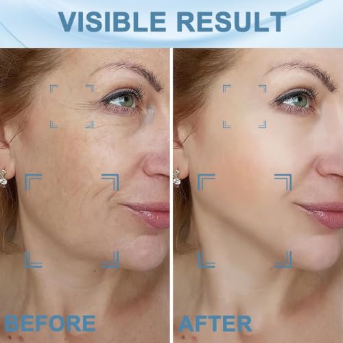 Image of KIMEE Face Massager, Anti-Aging Neck Eye Massager with 7 Colors 3 Modes, Facial Massager for Skin Care, Anti-Wrinkle Device for Slimming Face Electric Face Scrubber