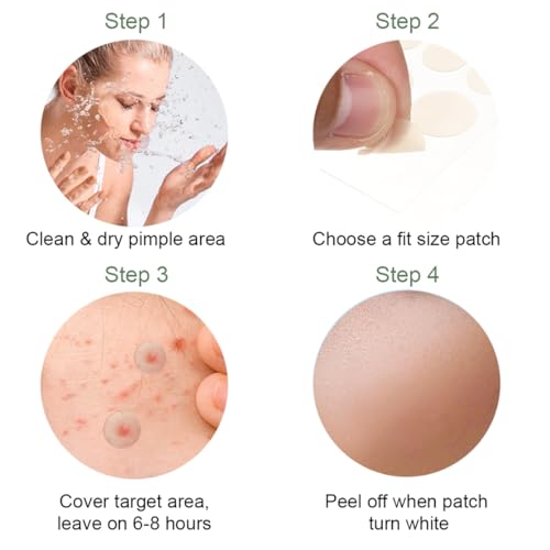 Unsichtbare Pickel Patch 408 Stück Hydrokolloid Akne Pflaster Wasserdicht Anti Pimple Patches für Unreinheiten Gesicht Aknebehandlung