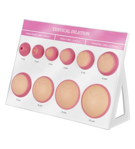 MedEduQuest Cervical Dilation Simulator Board with 1-10cm for Midwife and Doula Training, Gynecological Examination Model,Chart on Display Board Medical Education, and Birth Learning
