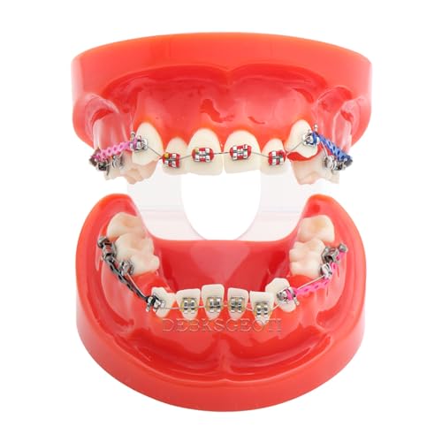Dental Model, Orthodontic Typodont, Teeth Model Braces, Premolars Deformity, with Arch Wire, Bracket, Single Buccal Tube, Ligature Ties, Teaching Practice Demonstration Tools (M3005-RED)