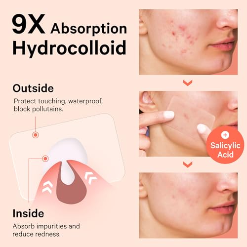 Image of Sosky Large Pimple Patches XL Hydrocolloid Acne Patches for Face & Body Cystic Pimple & Zit Patch for Nose Chin Back, Bacne & Breakouts Vegan Cruelty-Free（10 Count）
