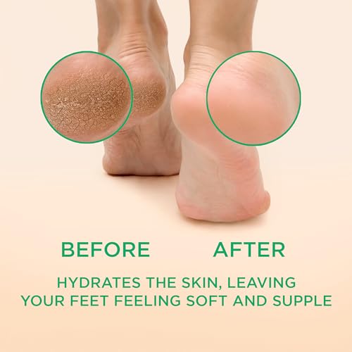 Image of Lee Beauty Professional Callus Remover for Feet - Peppermint, Powerful Formulation - Extra Strength Gel, Home Pedicure Foot Spa Results - Cracked & Dead Dry Skin Supplies - 8 Ounce