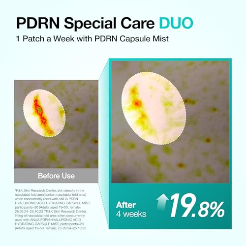 Image of ANUA Salmon DNA PDRN Collagen Melting Patch for Glass skin, Smile Line Patches, Wrinkle Patches, Melting Thin Collagen Patch, Firming for Fine Lines, Glow, Korean Skincare, 2 Pairs x 4EA, Patch Only