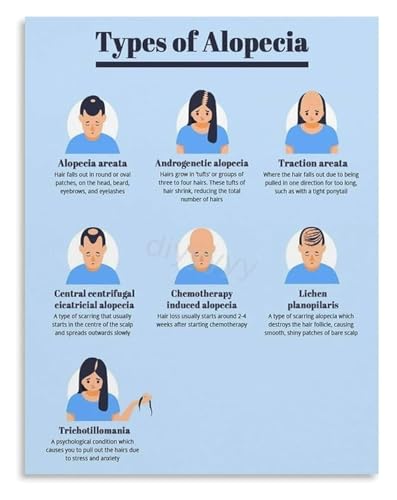 Poster perte de cheveux guide toile encadrée 40x60cm tableau calvitie alopécie