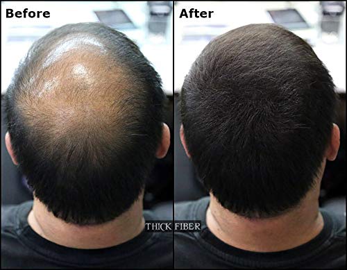 Thick Fiber TF-VARIATIONS Hair Fibers For Thinning Hair & Bald Spots thumb #4