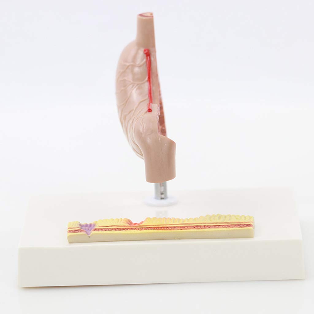 Model anatomiczny narządów ludzkich - Model anatomiczny żołądka naturalnej wielkości - Anatomiczny patologiczny żołądek Pomoce dydaktyczne i do nauki - do materiałów laboratoryjnych znakomite