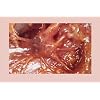 Lymphatic Drainage Massage