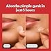 Mighty Patch™ Original patch from Hero Cosmetics – The #1 Hydrocolloid Acne Pimple Patch for Shrinking Zits and Whiteheads in 1 use; Nighttime Spot Stickers for Face and Skin (36 Count)
