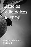 Estudios radiológicos de EPOC Estudios radiológicos de EPOC