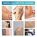 Advanced Silicone Scar Treatment Sheets for OLD, NEW Scars, Surgery, Keloids, C-Section, Burns, by NewGel Plus by MyNew Gel, 1
