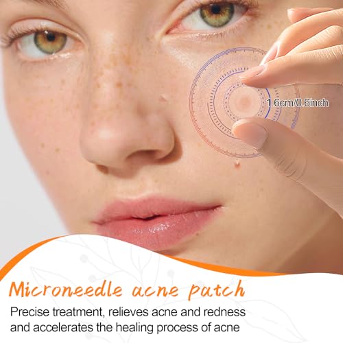 18 unidades/2 pacotes Microdart Patch para acne, microneedle com 322 microcristais, adesivos para ma