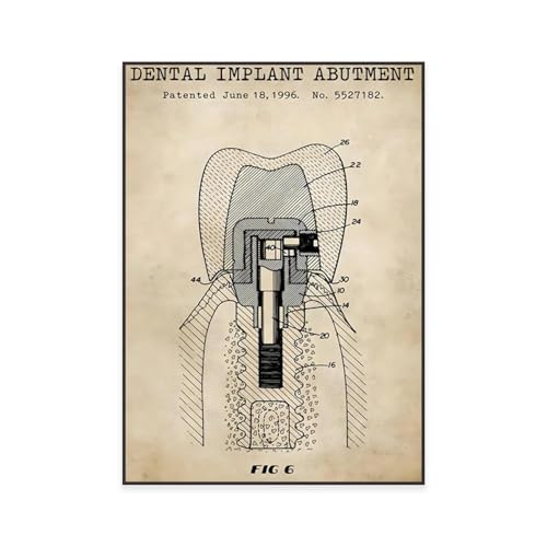 Zahnarzt Poster Dental Implantat Abutment Dental Klinik Zahnarzt Zahn Anatomie Leinwand Malerei Wandbild Wand Kunst Bild Home Dekoration 50X70Cm Kein Rahmen