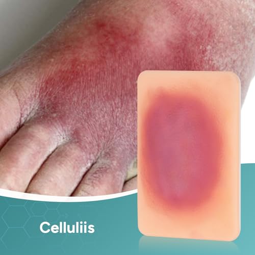Image of Bacterial Infected Wound Model for Medical Education | Wound Packing Trainer, Palm Sized Wound Simulation Models, Wound Care Demonstrations Tool, 4PCS